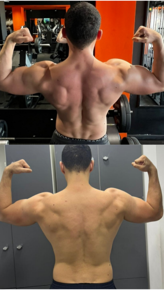 Physique Transformation Progress - Back and Shoulders